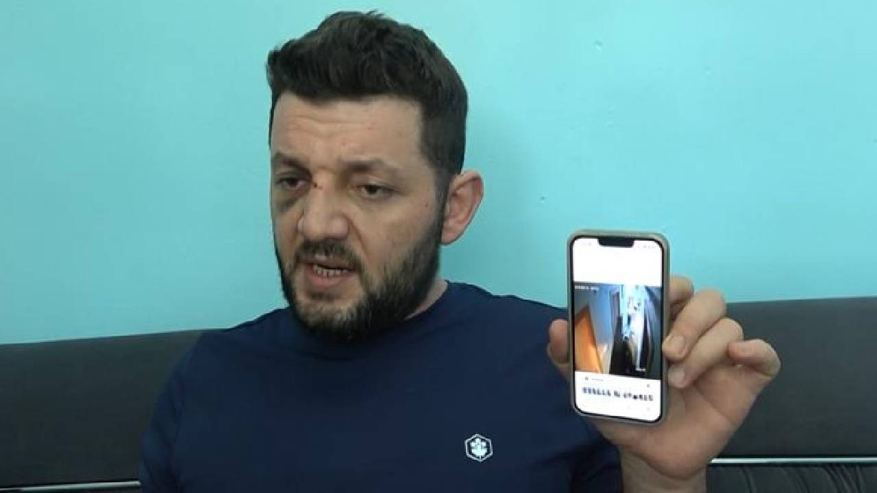 İkra bebekle babasının dövülmesiyle ilgili iddianame hazırlandı: Çocuk skuter'ı 'silah' sayıldı